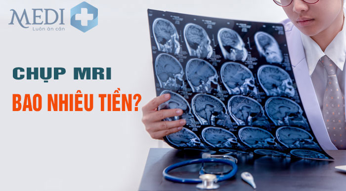 Chụp MRI bao nhiêu tiền – Bảng giá chụp cộng hưởng từ 2025