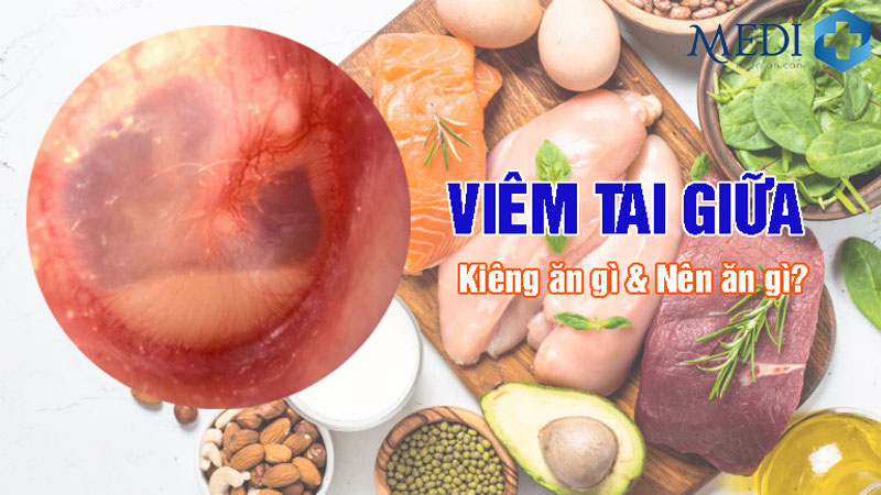 Viêm tai giữa kiêng ăn gì? Top 5 thực phẩm cần tránh