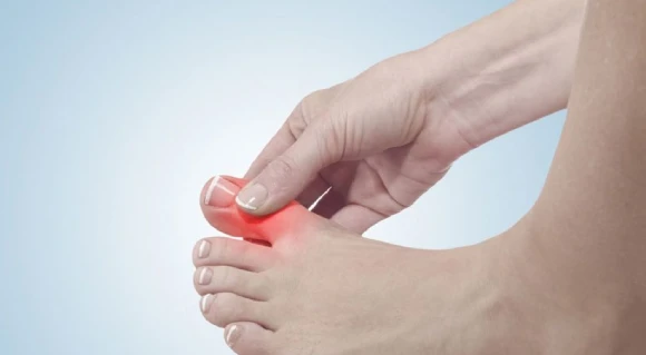 Ngón Chân Cái Bị Đau Buốt – Dấu Hiệu Cảnh Báo Bệnh Lý Gì?
