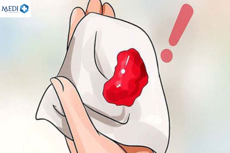 Vừa hết kinh quan hệ ra máu có sao không? Sau 1 – 10 ngày?